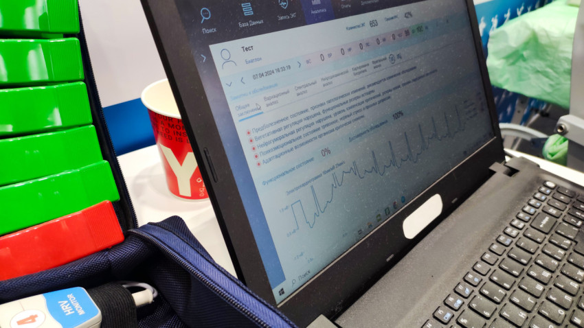 Экран ноутбука с результатами физиологического теста