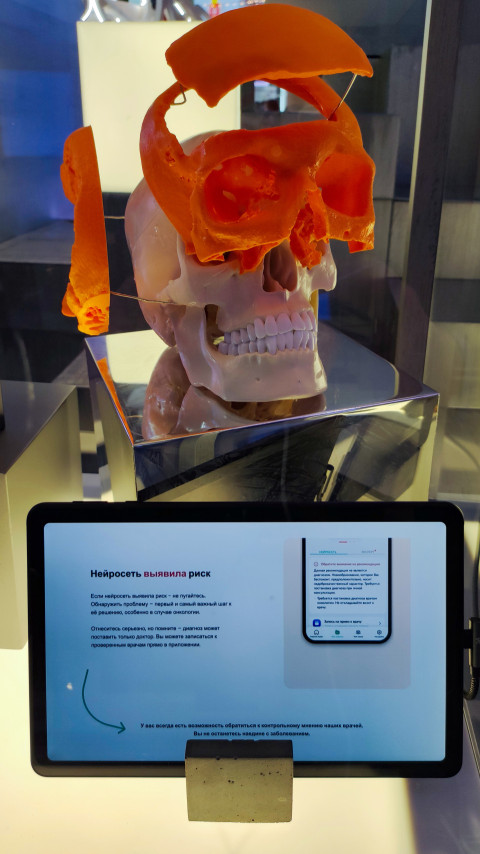 Череп с набором 3D-напечатанных имплантов на выставочном стенде