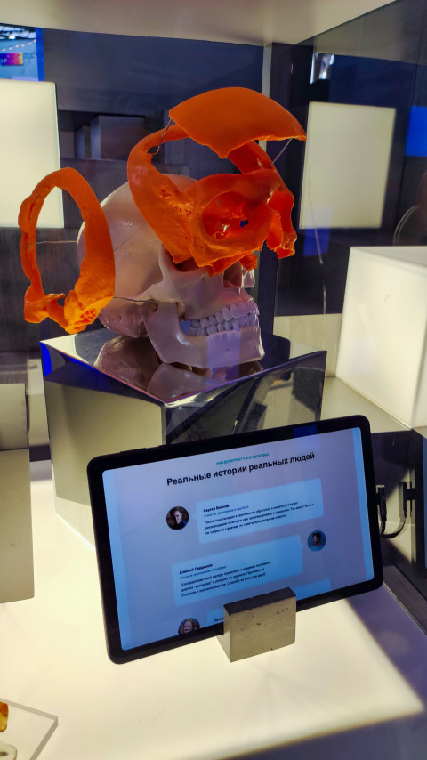 3D-модель черепа с демонстрацией реконструкционных элементов